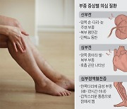 한쪽 다리에만 나타난 '이 증상'… 혈전 때문일 수도