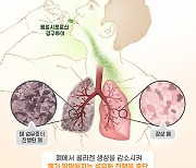 대웅제약 "美서 특발성 폐섬유증 신약 지속 개발 권고"