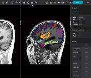 JLK, AI기반 뇌영역 분류시스템 국내 특허 취득