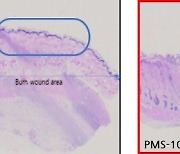 프리모리스테라퓨틱스, 화상치료제 호주 임상 1·2a상 IND 승인