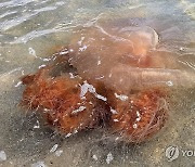 해파리 쏘임 신고 6건→562건…경북 해수욕장마다 비상