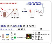 뇌사자 신장이식 성공률 높일 새로운 진단법 개발