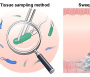 헬리코박터균 검사, 조직 채취 아닌 쓸어 담기하세요