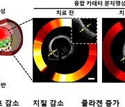 빛을 이용한 심장 혈관내 치료 기술 개발