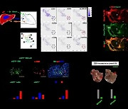 KAIST, 간암 종양 미세환경서 항암면역세포 억제 기전 규명