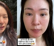 미자 충격적인 민낯 공개, 땀샘오픈에 “피부 상태 초토화”