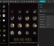 제이엘케이, FDA에 뇌관류 MR 분석 솔루션 인허가 신청