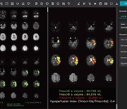 제이엘케이, 뇌관류 MR 영상 분석 솔루션…美FDA 인허가 신청