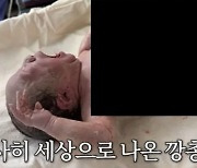 '강재준♥' 이은형, 아들 출산 과정…"숨 안 쉬어져 진상 부렸다"