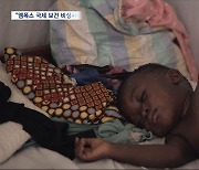 엠폭스 확산에 국제보건 비상사태 선포‥"백신 접근성 중요"