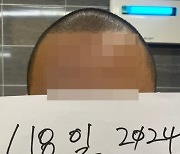 음식에 2㎝ 머리카락 나왔다고?…"제 머리 보세요" 업주 대반격