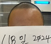 "음식서 머리카락 나와... 환불 해달라" 고객 요청에 사장이 공개한 사진