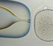 경기도, 난자·정자 동결시술비 최대 200만 원 지원 추진