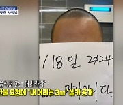 [인터넷 와글와글] 환불 요청에 "내 머리는 3㎜" 셀카 공개