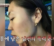 “가정폭력으로 보호관찰” 아내에 복수하는 남편, 폭행 수위 충격(이혼숙려캠프)