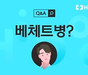 구강 궤양 자주 생기면 ‘베체트병’일까? [1분 Q&A]