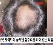 원형 탈모인 듯 ‘텅’…66명 학생 머리 바리깡으로 밀어버린 교사