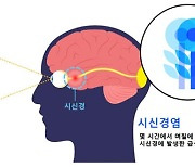 서울대병원, 유형별 시신경염 예후인자 규명