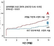 ‘복잡한 관상동맥 질환’, 광간섭단층촬영으로 예후 개선