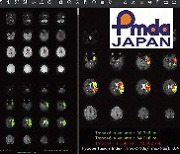 제이엘케이, 뇌졸중 솔루션 日 PMDA에 인허가 신청
