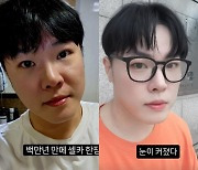 '성형설' 휘성 "17kg 감량으로 눈 커져" 루머 일축