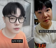 휘성, '성형·건강이상설 일축' 17kg 감량…"아직 폼 안 죽어" [엑's 이슈]