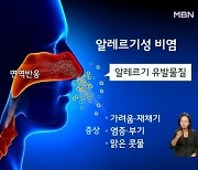 밤공기에 콧물 줄줄·재채기 계속…환절기 심해지는 비염