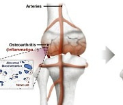 노인 여성 절반 앓는 '관절염'…넥스트바이오, 새로운 통증 완화법 내놔