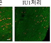 치매 등 노인성 질환 효과적 치료제 개발 가능성…기존 약물 새 항노화 효과 규명