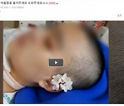 "반성문 '꼼수 감형' 폐지를"... 폭행당해 식물인간 된 딸 어머니 국회청원