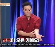 김창옥, 옻독 오른 자국 공개 “옻칠 배우는 중”(김창옥쇼3)