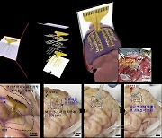 기초연·KIST, 뇌 인터페이스 신축 전자패치 개발