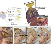 IBS, 대뇌피질 전자패치 개발…뇌 표면 밀착해 잡음없이 뇌파 계측