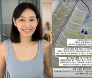 박탐희, 추석연휴 병원 신세 어쩌나 "정신적 타격→살 스치기만 해도 통증"