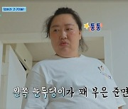 염정아, 모기 물려 눈 퉁퉁 부은 박준면 비주얼에 ‘풉’ 폭소(산지직송)