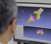 AI가 무릎뼈 탈구도 예측 진단