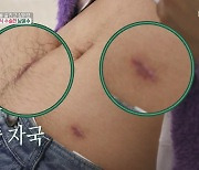 효자 남윤수 “父, 신장 이식 반대했지만…혼자 묵묵히 준비했다”(편스토랑)