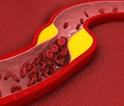 "LDL 콜레스테롤 낮추자" 바람 불더니…치료율 오르고 혈관질환 줄어