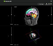 "해외로 간다"…휴런, '알츠하이머 예측 AI' 대만서 승인