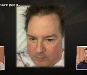 '충격 고백' 로버트 할리 "희귀암 투병..근육이 다 녹았다"