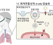 [사이언스씬] KAIST, 코로 흡입하는 폐질환 치료법 개발