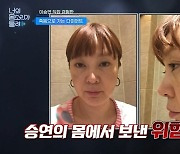 이승연 “3금융+사채 쓴 격” 30kg 빼느라 부작용 폭격 맞은 얼굴 공개(너몸들)