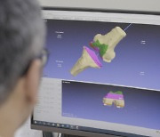 연세사랑병원, ‘슬개골(무릎뼈) 탈구’AI 예측 진단법 공개