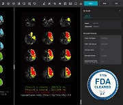 제이엘케이, 뇌졸중 솔루션 FDA 승인 획득…올해 3번째