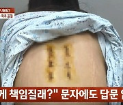 '여친 던지기 게임'에 척추뼈 3개 부러졌는데…男 "기억 안나"