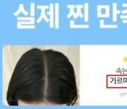 화장품으로 탈모 치료?…"허위 광고입니다"