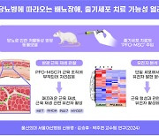 당뇨병에 따라오는 배뇨장애, 줄기세포 치료 가능성 열려