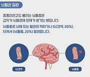 “이웃·손·발·시선” 뇌졸중 걱정된다면···이것만큼은 꼭 [헬시타임]