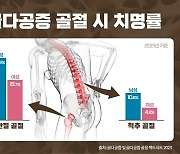 “남성도 골다공증 위험, 발생시 치명률 여성보다 높아”