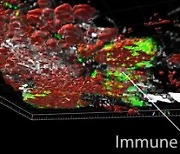 [사이테크+] "유방암·대장암 등 6개 암 종양의 3차원 구조 지도 완성"